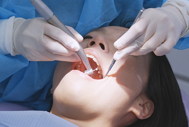 PMTC（Professional Mechanical Tooth Cleaning）