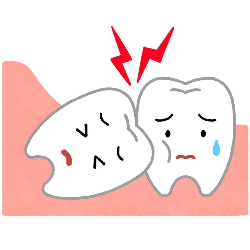 【徹底解説】親知らずは必ず抜くべき?抜歯の判断基準と放置するリスク
