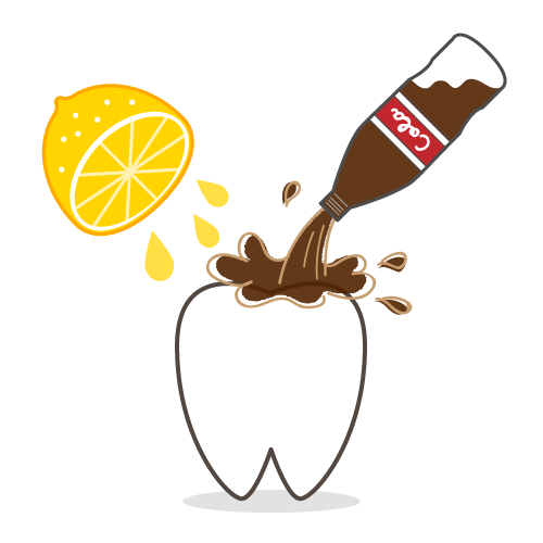 健康意識が高い人ほど注意?🍋歯が溶ける「酸蝕症」の正体と対策